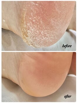 ラヴィ(La vie)/お祭り行く前に