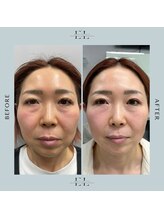 ラプティット(La petite)/50代女性/2回の変化