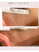 パルティノ 高崎店/ワックス脱毛