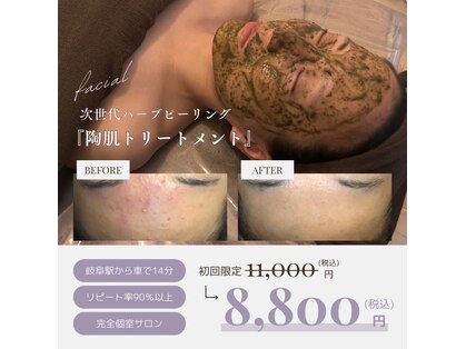 ポラリス(Polaris)の写真