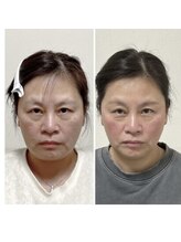 小顔22 ボルティ 本店(Bolty)/小顔シンメトリー矯正＆全身矯正