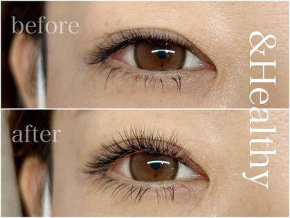 シェノン(Chainon)の写真