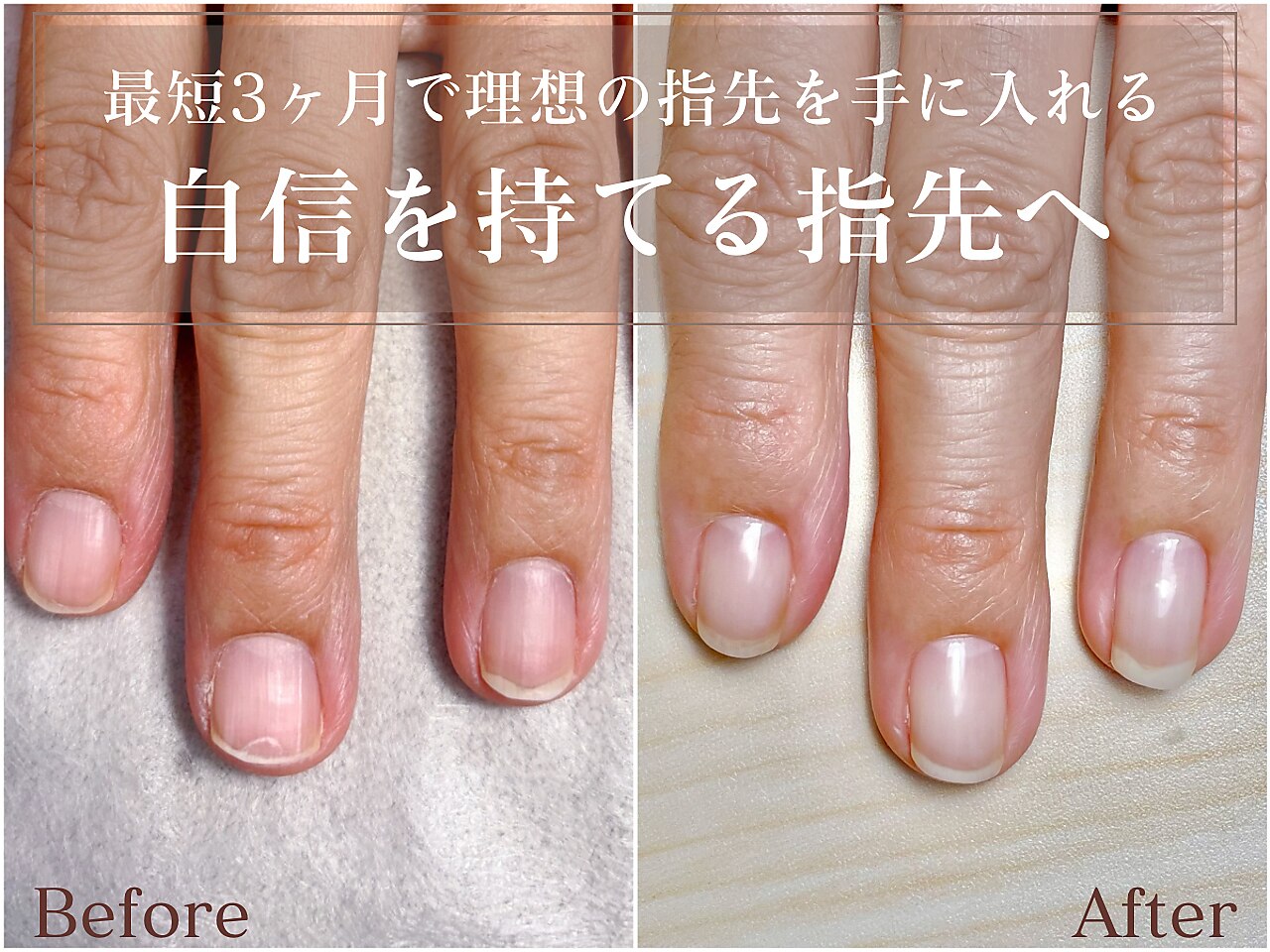 ナル(Nalu.)｜ホットペッパービューティー
