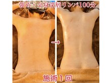 強め筋膜痩身リンパ 小顔エステBAR北野