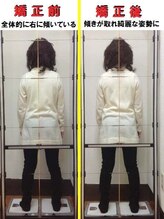 すこやか接骨院/ビフォーアフター　２