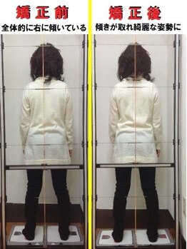 すこやか接骨院/ビフォーアフター 2