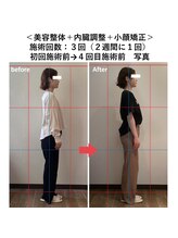 ぷめはな整体/美容整体+小顔矯正+内臓調整