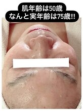 マイン イオンモール浜松市野店/大人気！リセラ美肌活性！