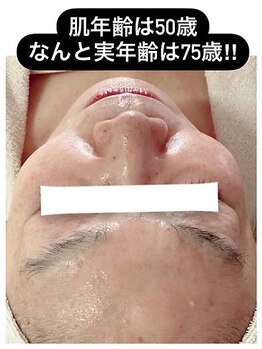 マイン イオンモール浜松市野店/大人気！リセラ美肌活性！