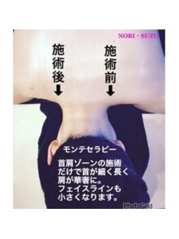 ノリスズ(NORI SUZU)/首肩こり・小顔・首シワも改善