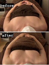 ビジュ(BijoU)/◇施術イメージ◇