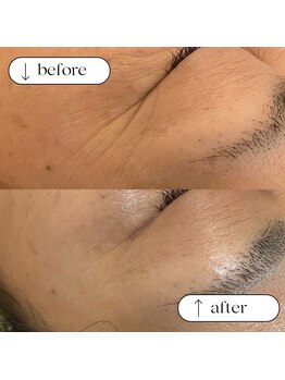 トータルビューティーサロンリア(Li'a)/ビフォー＆アフター