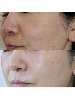 ザ シー タイムレスビューティ(THE SHE)/40代お客様症例写真