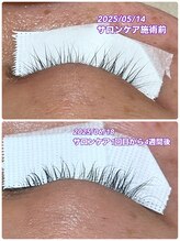 ボーグル ビューティー(BOGL BEAUTY)/サロン専用高濃度美容液ケア