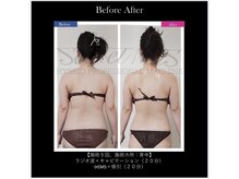 エキュレ ジャーニー トゥ マイ トータル ビューティー(equrer)/福山初導入!シークレットメスPro