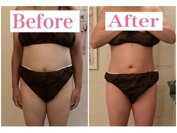 トータルビューティーサロン 凛