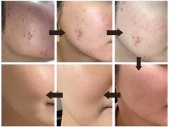 アイル 船橋店(iru)/