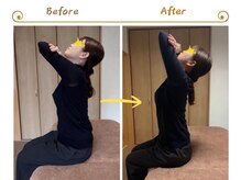 アイノテ メディカルボディケア(Ainote medical body care)/［首・肩こりの施術例紹介］
