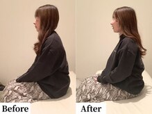 ソレア(Solea)/肩こり・首こり・姿勢改善1回目