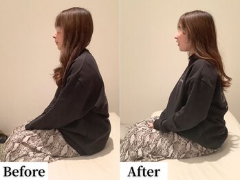 ソレア(Solea)/肩こり・首こり・姿勢改善1回目