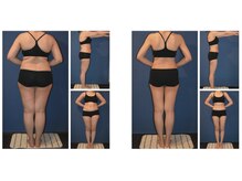 フェムプリュ(femplus)/エンダモロジー全身フルリセット