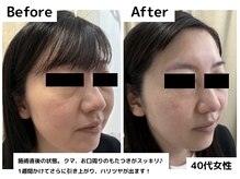 ボニータアンジュ 恵比寿(Bonita Ange)/恵比寿・渋谷｜ポレーション