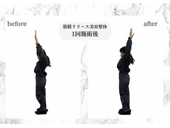 トキ(TOKI)/筋膜リリース美容整体 施術直後