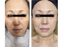 アズリー ルナ(AzRee Luna)/リアボーテハーブトリートメント