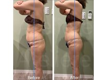 アトリエール(Ateliere)/姿勢矯正(初回)