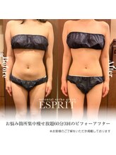 エスプリ 銀座店/銀座痩身・痩せる・ダイエット