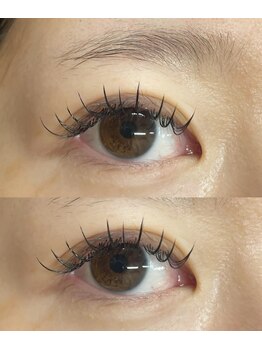 ビュー(V.I.E.W)/BINDLOCK100束