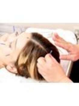 本間鍼灸治療院/美容鍼