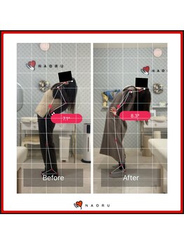 ナオル整体 錦糸町院(NAORU整体)/後屈可動域改善