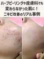 ロエヴェ(ROEWE) 千葉店 Staff