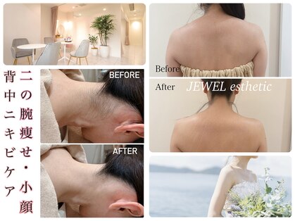 ブライダルエステ ジュエル(JEWEL)の写真