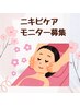 ★ニキビケアモニター様/高濃度ビタミンピーリング　5回　25000円★