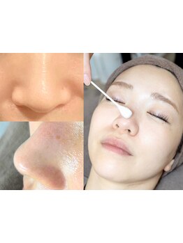 毛穴ケアをしたい