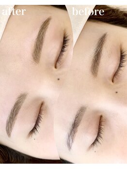 レオラ(Leola)/ハリウッドブロウリフト