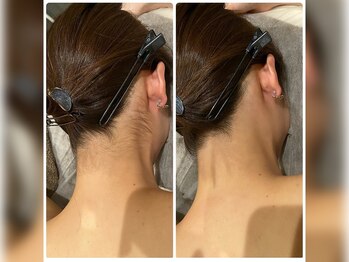 デトックススパボディーラボ/キッズ脱毛は小学5～中学3年迄☆