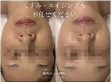 クレア(CLEA)の雰囲気（クリスティーナ・ハーブリプロでシミにも徹底アプローチ ◎）