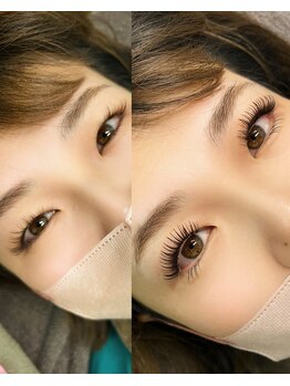 エムエム(mm)/エクステパーマ