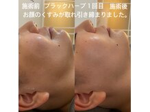 グロース(growth)の雰囲気（10代～70代◎お悩み肌に合わせたハーブと美容液を導入理想の肌へ）