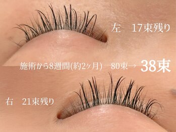 フロング(Furong)/バインドロック装着から2ヶ月後