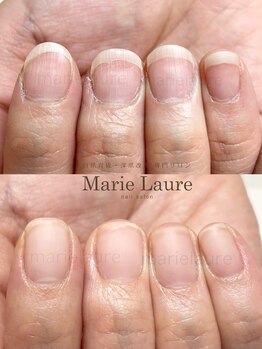 マリーロール 淀屋橋本店(Marie Laure)/深爪矯正/自爪育成/ネイルケア