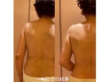 凪 横浜の雰囲気（浮腫み、疲れを改善して本来のボディラインをつくる1回での結果）