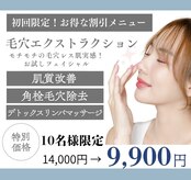 シェノン(Chainon)
