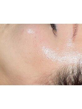 ハリツヤをUPしたい