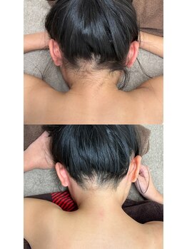 スマイルネイル(SMILE NAIL)/キッズ脱毛デビュー