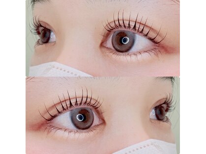 ビーケアズビューティー(be-cares beauty)の写真