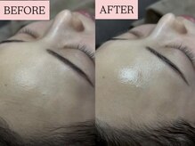 オンフリーク(ON FLEEK)の雰囲気（剥離・ダウンタイムほぼなし！次世代ピーリングで艶肌を育てる♪）